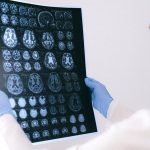 A medical professional reviewing MRI brain scans in a clinical setting, highlighting healthcare technology.