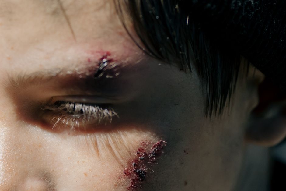 The Trauma Trap: Why Future-Proofing Requires Psychological Awareness